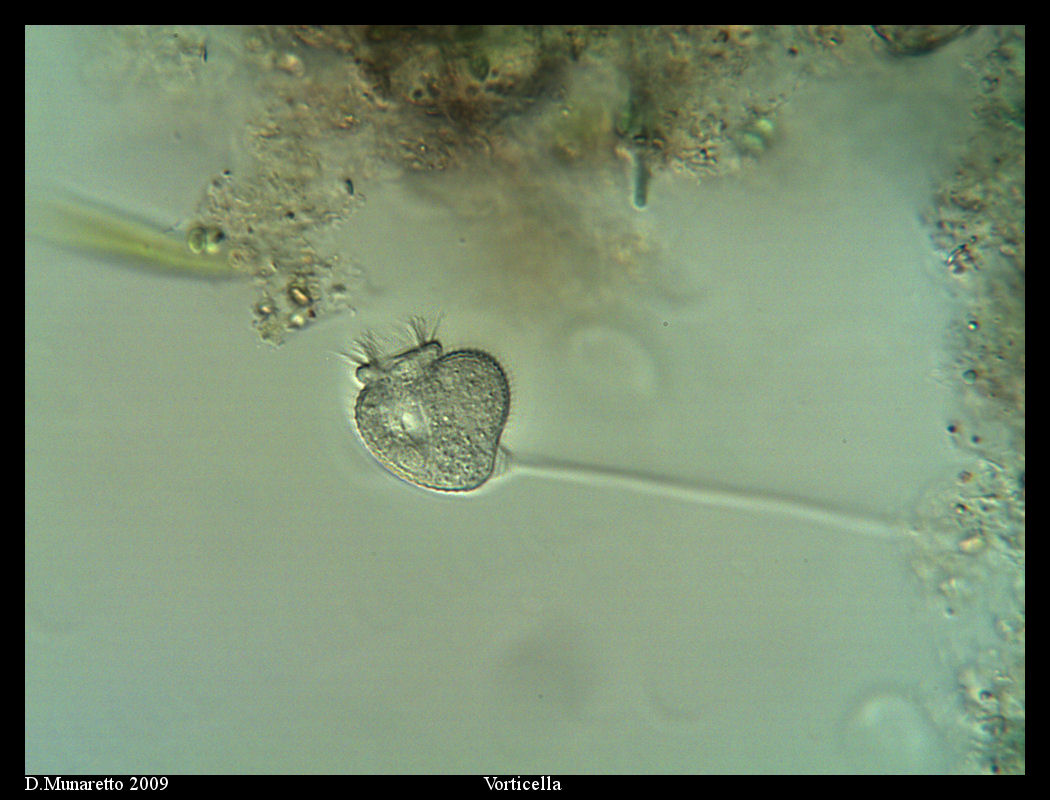 Vorticella